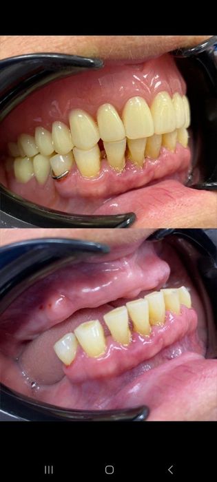 Зубний технік!Співпраця зі стоматологом