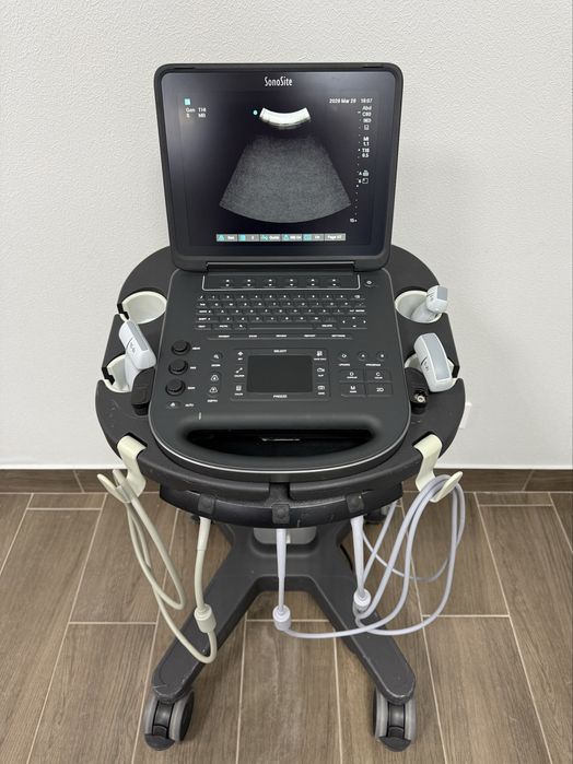 Продам УЗИ аппарат (УЗД апарат) SonoSite Edge ||