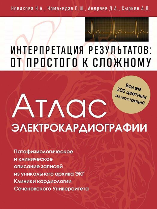 Атлас электрокардиографии. Интерпретация результатов