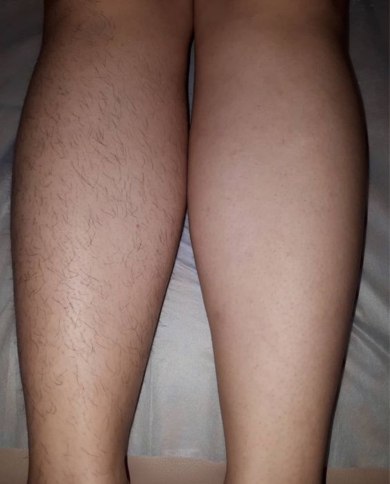 Шугаринг муж/жен, обучение