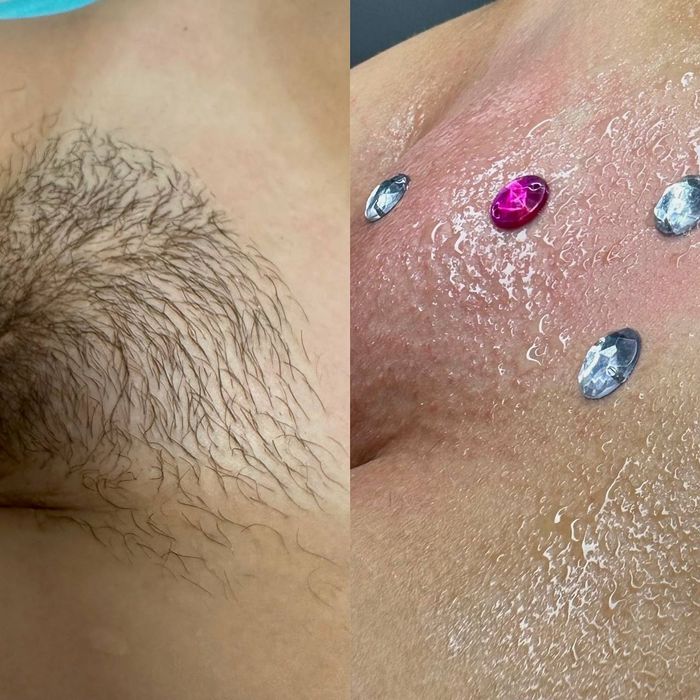 Депіляція для жінок і чоловіків, вагітних, підлітків