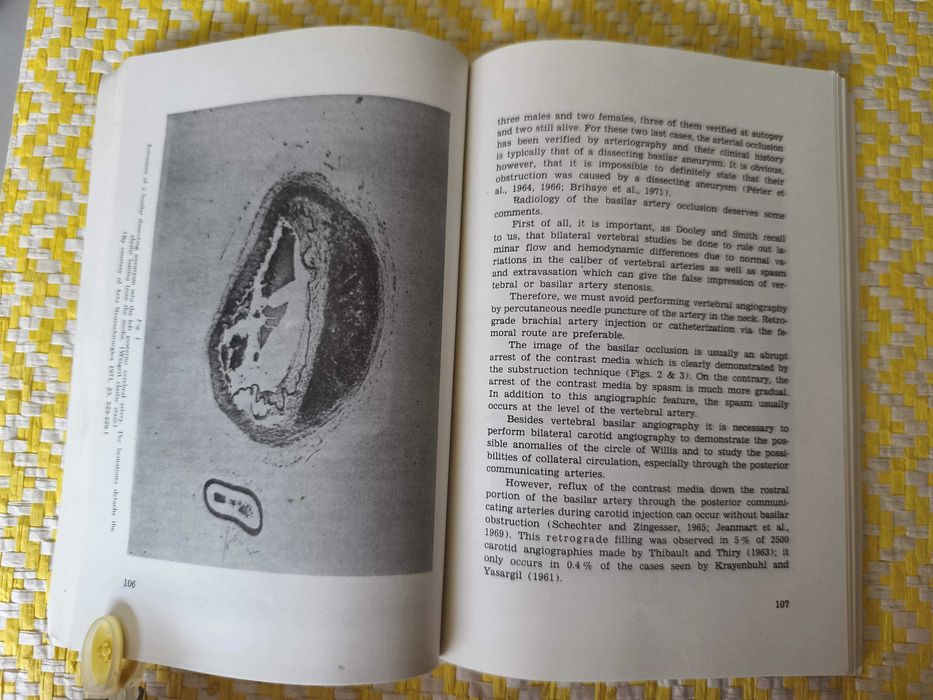 Egas Moniz Centenary . Scintific Reports