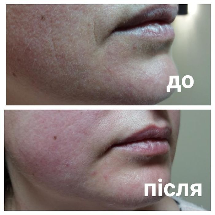Масаж ОБЛИЧЧА та ТІЛА. Метро Деміївська.