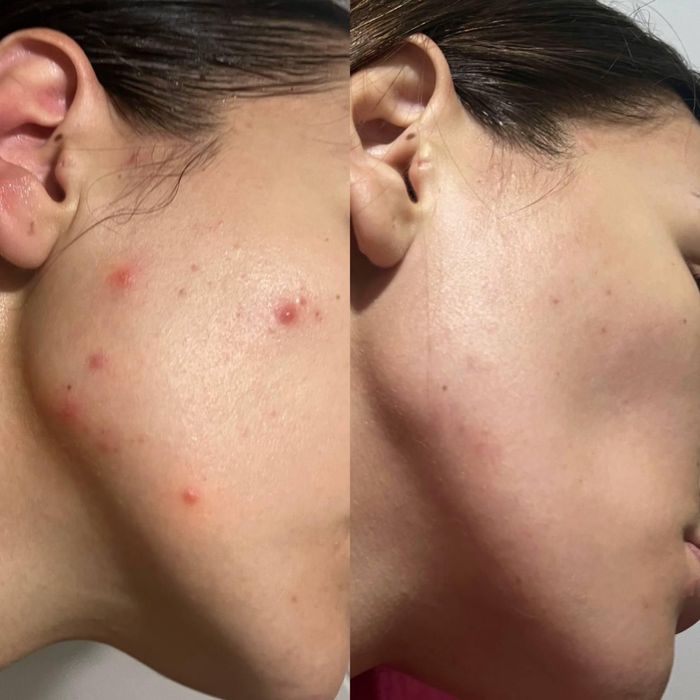 Лікар-Косметолог-Дерматолог Коммунарівський р-н,піски,4-й південний