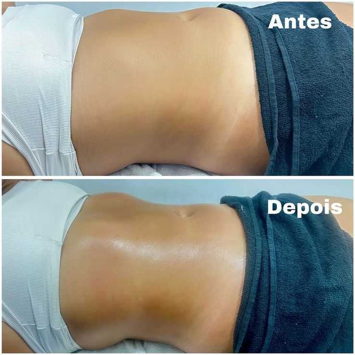 Drenagem Linfática facial e corporal