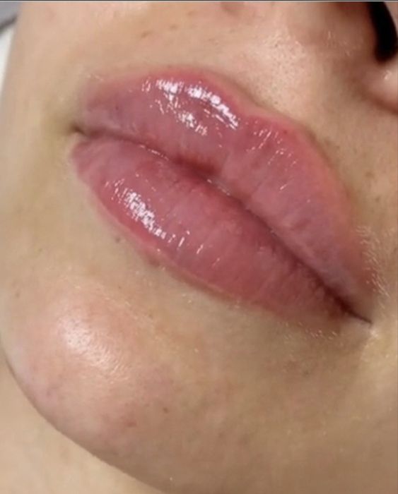 Косметология,. Массаж. Днепр.  пр. Слобожанский