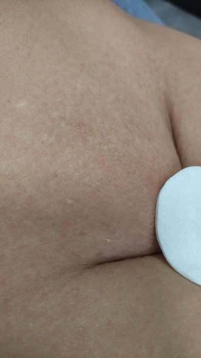 Женская , мужская депиляция