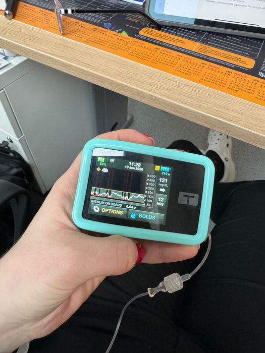 Tandem tslim control iq