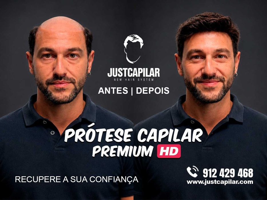 Prótese Capilar com Colocação e Corte, efeito real e imediato, em 2 horas volte a sorrir!