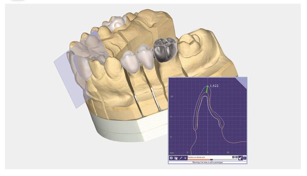 Exocad DentalCAD Implant Lab Bundle • Оригінальна ліцензія