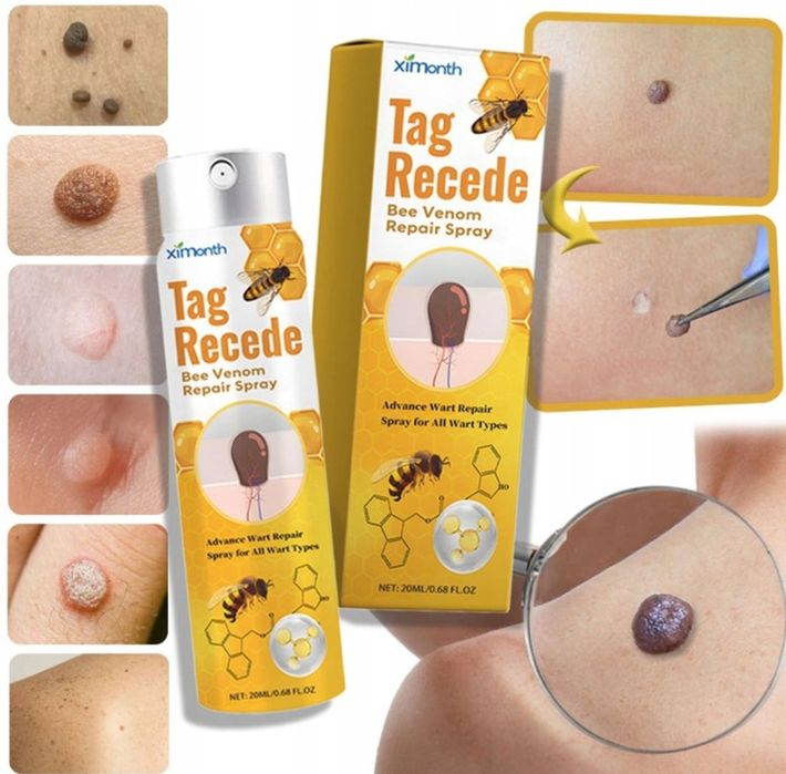 Hit! Preparat do usuwania brodawek