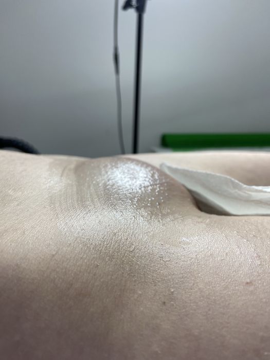 Депиляция Шугаринг Воск ЛАЗЕР