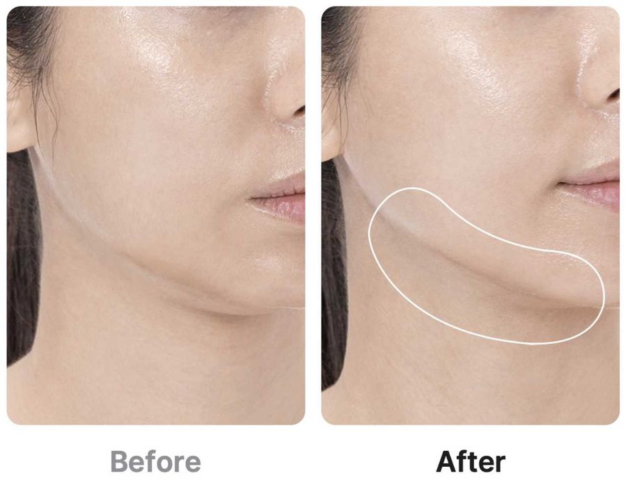 [Medicube] Age-R Booster Pro purple