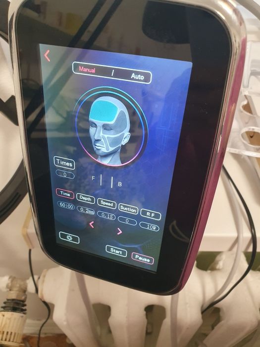 Апарат голковий рф