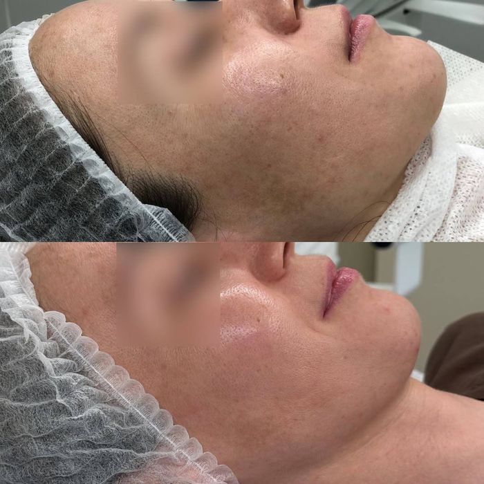 Лікар косметолог львів ботокс чистка обличя пілінг для обличя