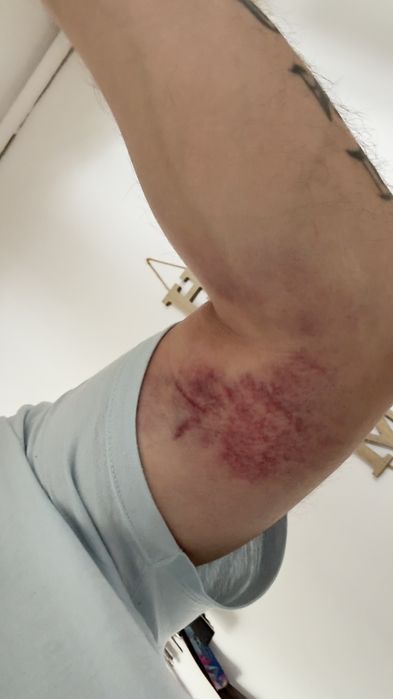 Rehabilitacja domowa/ Fizjoterapia