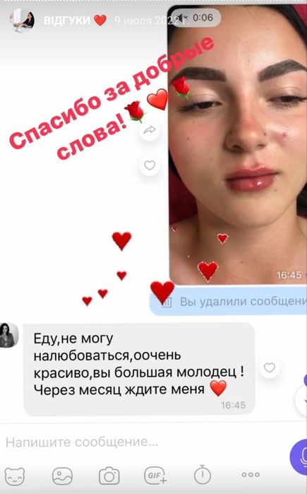 Губи АКЦІЯ. Лікар косметолог.