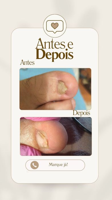 Pedicure medicinal ao domicílio