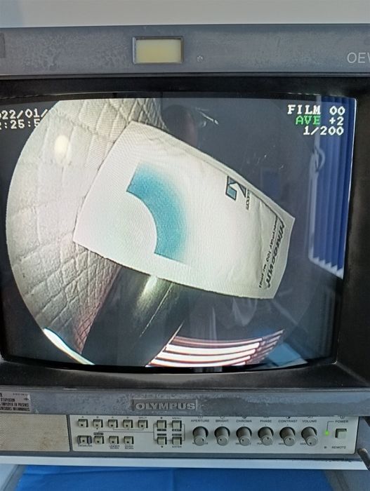 Процесор Fujinon epx 2200 з колоноскопом та монітором.