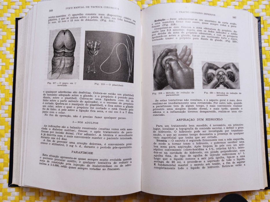 Manual de técnica cirúrgica
de PYE
Editado por: James Kyle