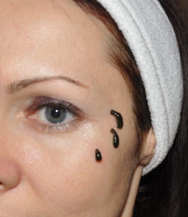 Гірудотерапія та мануальна терапія