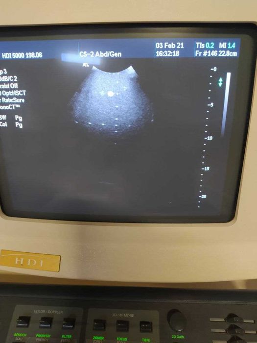 Мікроконвексний датчик УЗД Philips C8-5 (Connector Pin)