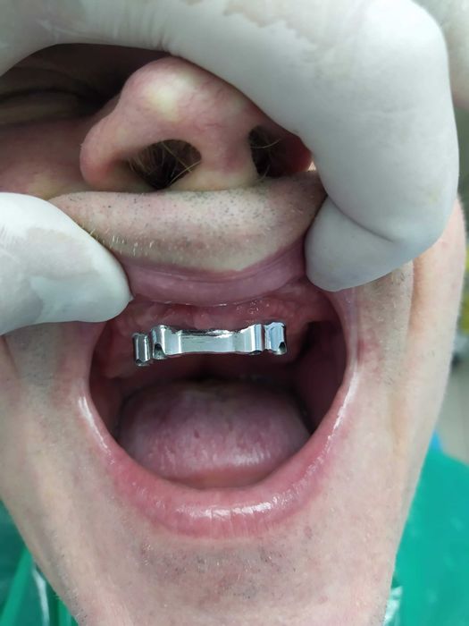 Стоматология. Протезирование .Имплантолгия