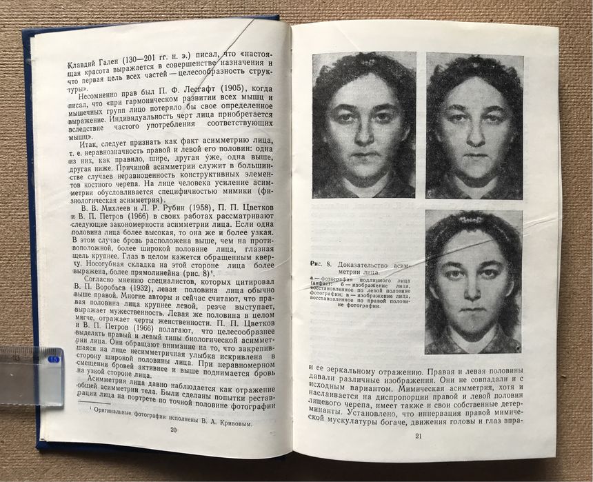 Лицо человека: анатомия,мимика. В.В. Куприянов , Г.В. Стовичек