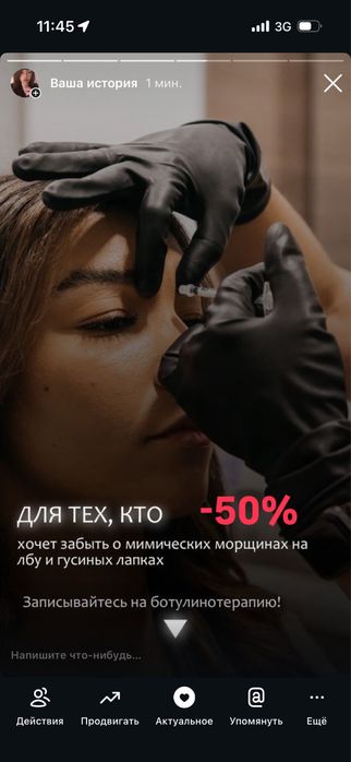 Косметолог моделі на(губи,ботокс,смас,рф голка,схуднення,худе обличчя)