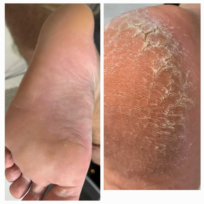 Manicure, Pedicure e Progressiva