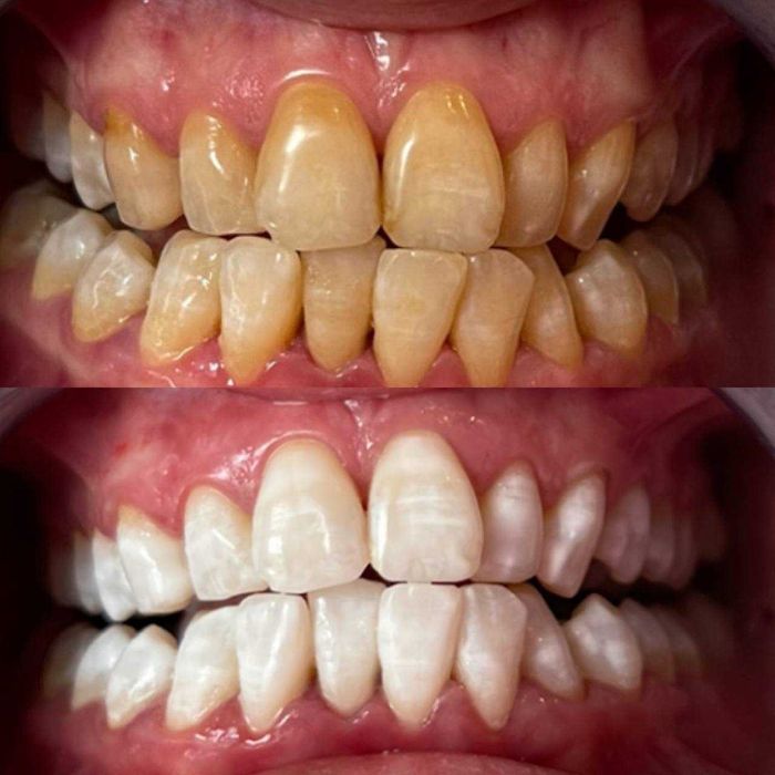 Косметичний бізнес / Франшиза відбілювання зубів Smile LAB