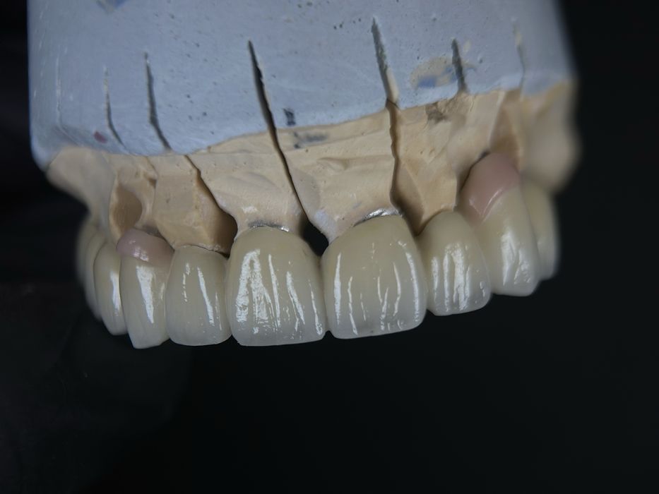 Послуги зубного техніка