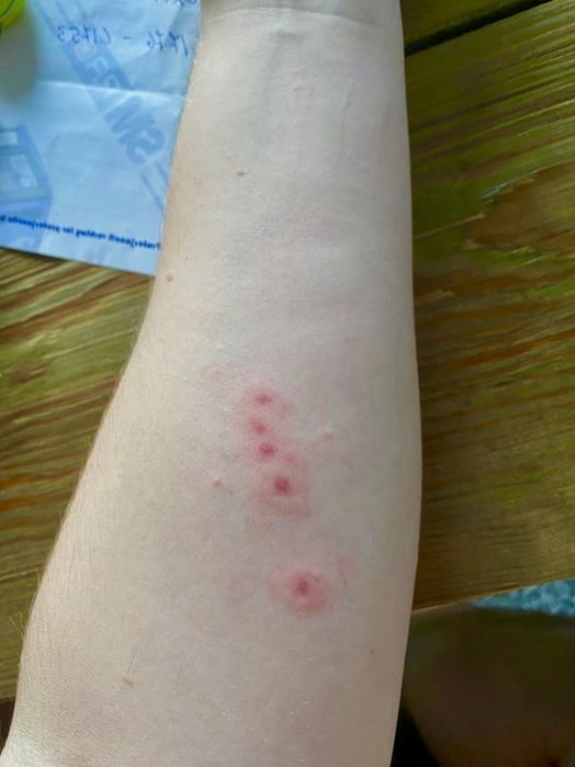 Desinfestação de Percevejos & Baratas em Lisboa & Margem Sul