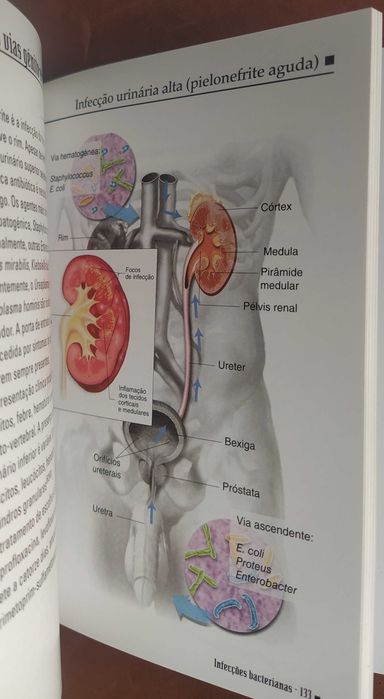Infecções bacterianas-Miniatlas