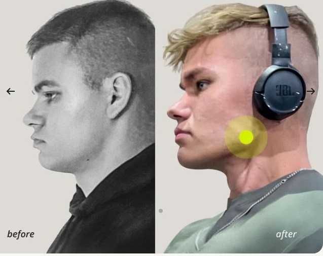 Jawliner Hard для чуинга , 1 пачка более 2 месяцев использования , для чёткой, более выраженной нижней челюсти и прорисованных черт лица