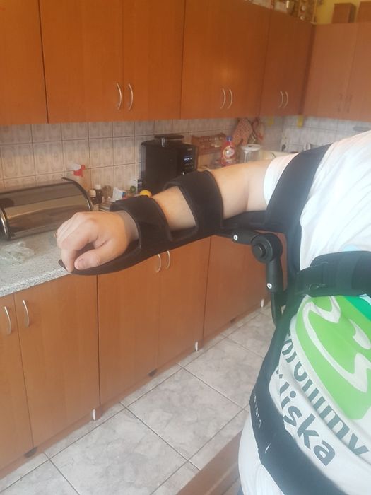 Orteza Kończyny Górnej Barku