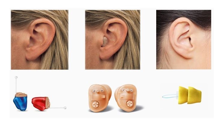 PREÇOS FÁBRICA APARELHOS Auditivos novos  Exame Gratuito