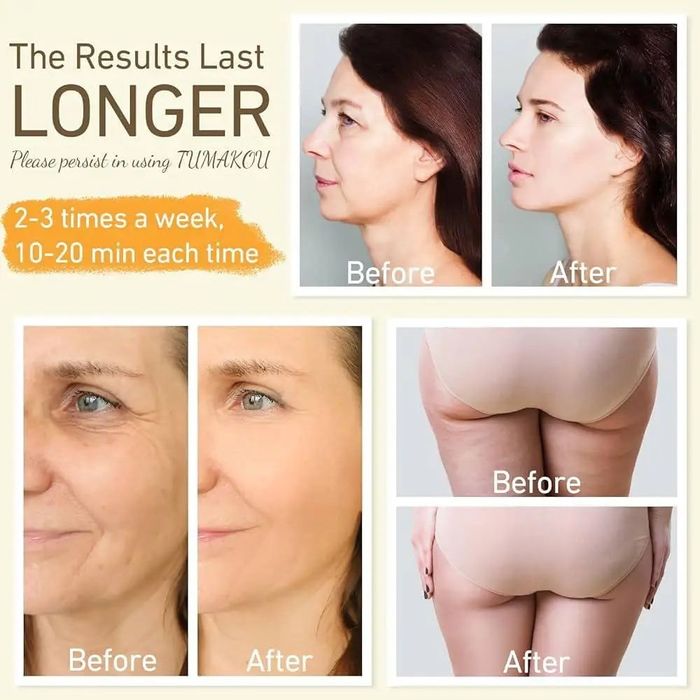 Професійний апарат RF-ліфтингу Uaike RF Radio Frequency для обличчя