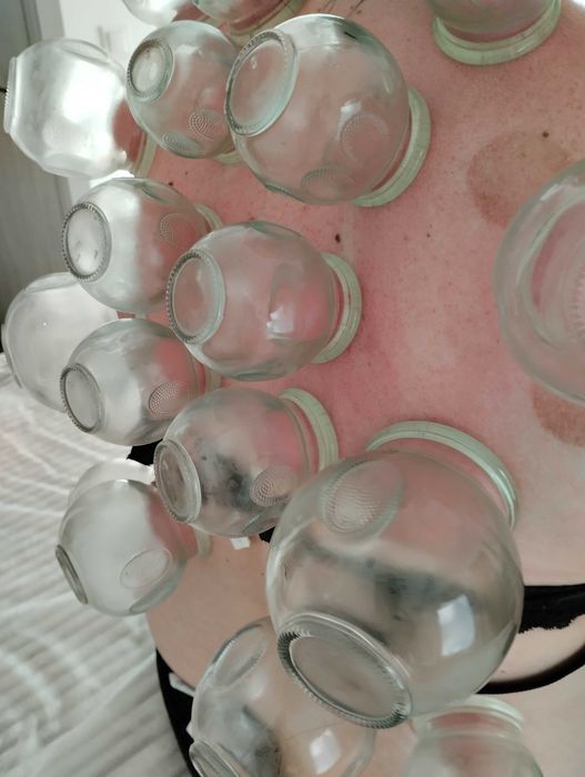 Terapia bańka ogniowa MiM Harmonia