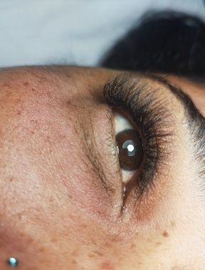 Estética Avançada (Micropigmentaçao Facial , Tratamento de estrias…)