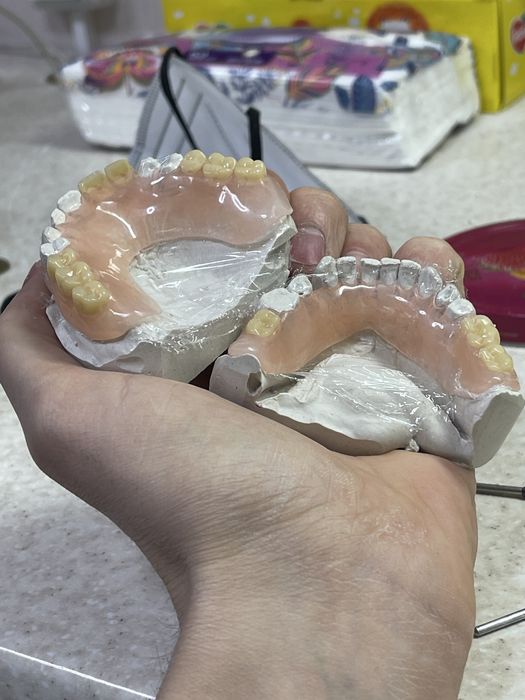 Инжекция (пресовка, стрелка) нейлоновый (термопласт) протезов