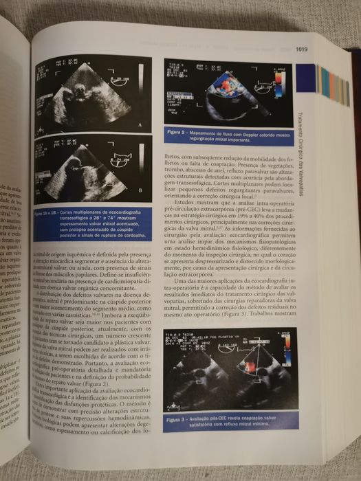 Tratado de Cardiologia