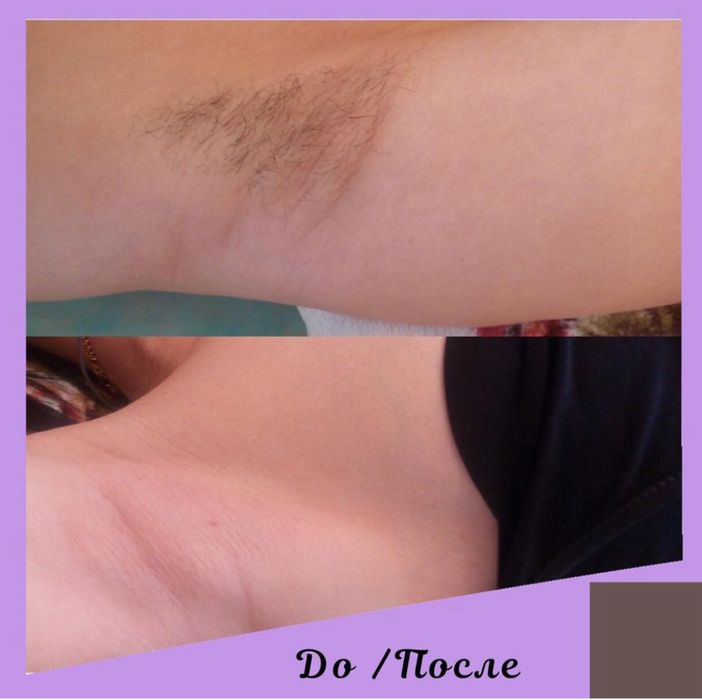 Шугаринг муж/жен, обучение