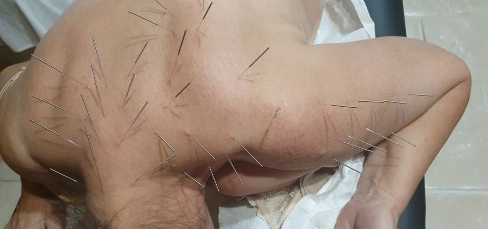 Usługi Masażu i Akupunktury