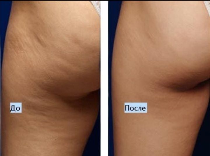 Массаж кезінде ренжіді