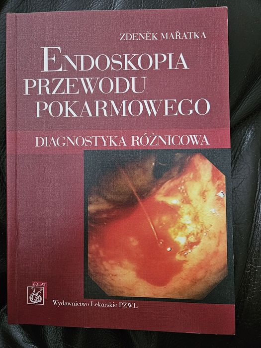 "Endoskopia przewodu pokarmowego " Z. Mařatka