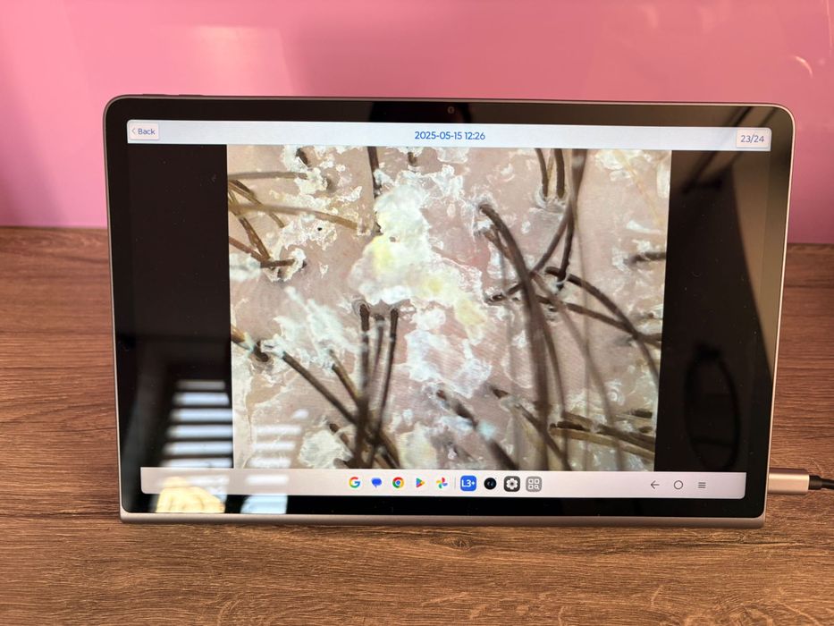 Kamera trychologiaczna z tabletem i oprogramowaniem