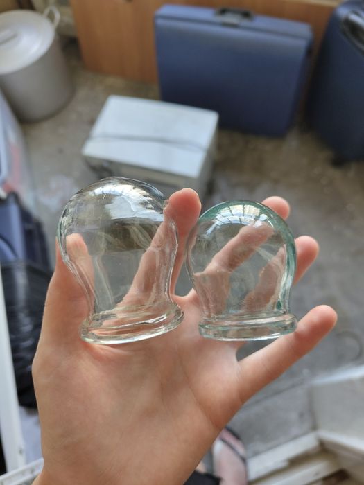 Баночки для массажа