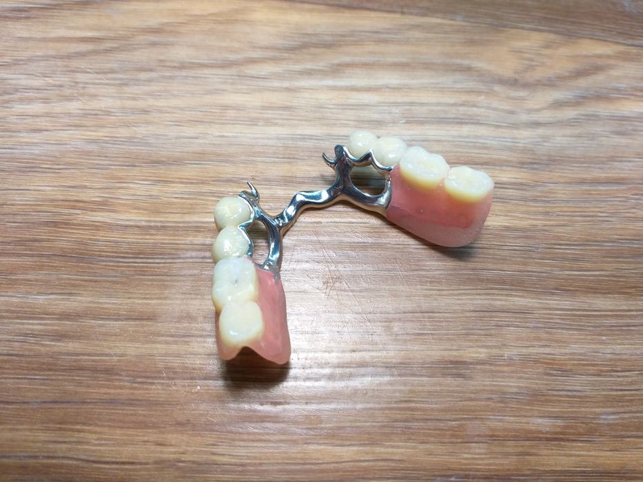 Зубний технік. Зуботехнічна Лабораторія  "Dental LAB"