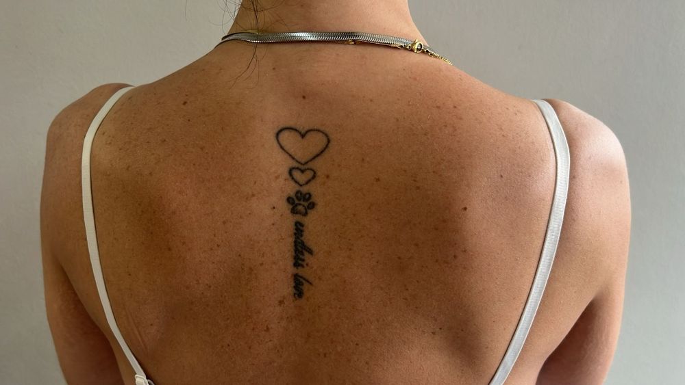 Modelos - Remoção de Tatuagem a Laser e Peeling de Hollywood